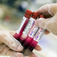 Image for article titled Scientists Say They've Created a Blood Test for Detecting Early Lung Cancer